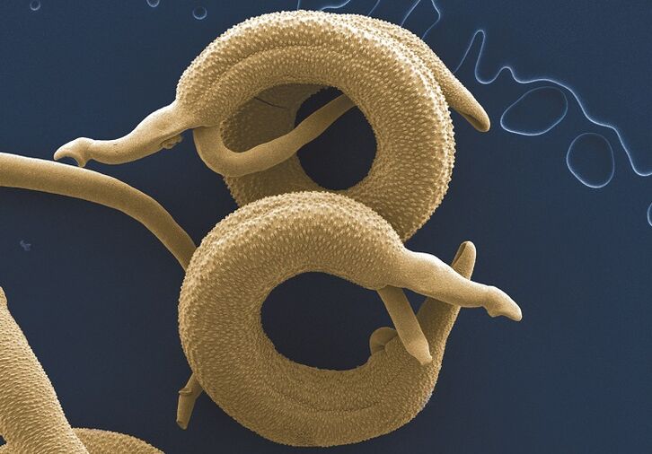Types of parasite in the body