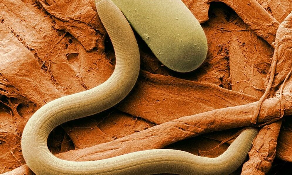 a worm parasite from the human body
