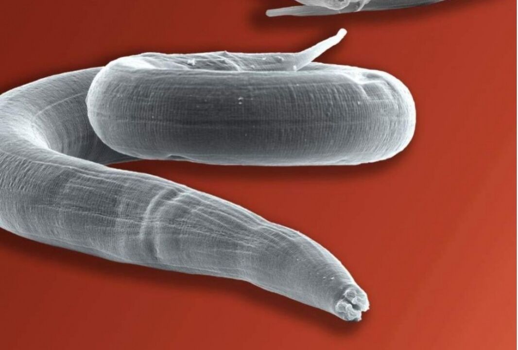 pinworm from the human body