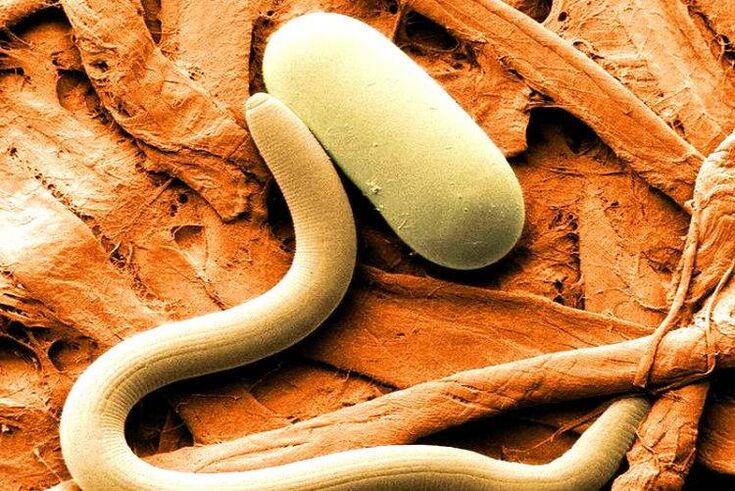 parasites in the human body