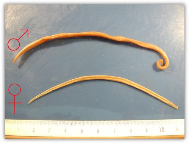 The size of a roundworm