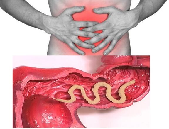 Parasite symptoms giardia, Giardia parasite human symptoms